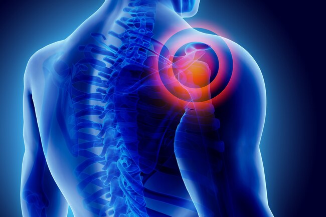 Healthy Street - 🔊 FROZEN SHOULDER - CAN MASSAGE AND EXERCISE HELP? Frozen  shoulder is a condition where an individual will experience pain and  stiffness in the shoulder and is not able